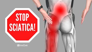 How to Relieve Sciatica Pain in SECONDS [upl. by Erdnassac407]