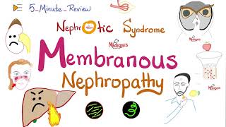 Membranous Nephropathy  Nephrotic Syndrome  5Minute Review Series [upl. by Iadam823]