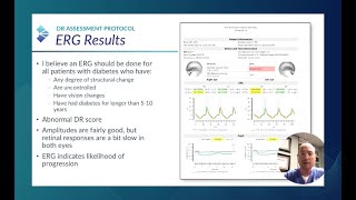 RETeval Case Study ERG Alters Followup Schedule and Education Nate Lighthizer OD FAAO [upl. by Elburr]