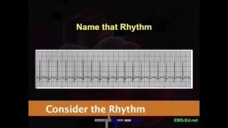 Intro EKG Interpretation Part 2 [upl. by Asseral]