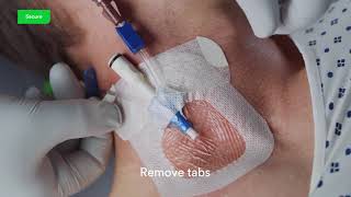 3M™ Tegaderm™ Antimicrobial IV Advanced Securement Dressing 9132 Application and Removal video [upl. by Ariaet305]