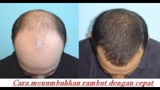 Cara Membuat Minyak Kemiri Murni penyubur rambut rontok anti uban [upl. by Riamo441]