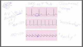 Junctional Rhythms [upl. by Anton]