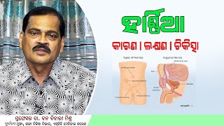 Hernia Causes Symptoms Treatment Advice Health Tips Doctor Tips SUSTTHA ODISHA [upl. by Eolanda]