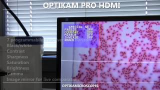 OPTIKAM PRO HDMI [upl. by Carling]