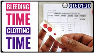 BT CT Test  Bleeding Time AND Clotting Time Coagulation Time Blood Test [upl. by Anikes]