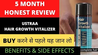 जानिए पूरा सच  Ustraa Hair Growth Vitalizer 100 Real 5 Month use review  BIG FIT [upl. by Inad62]