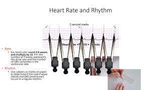 EKG Rhythm Interpretation and Atrial rhythms [upl. by Ereveneug881]