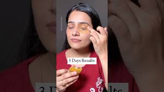 Magical 3 Days Dark Circles Removal DIY Cream Remove Eye Wrinkles beauty darkcircles skincare [upl. by Erotavlas]