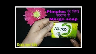 Margo soap Review hindi me ll Margo soap for pimples skin [upl. by Terrag657]