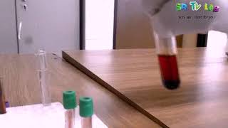 What is hemolysis hemolysis experiment using water [upl. by Kendal]