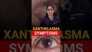 Most Common Symptoms Xanthelasma [upl. by Gertie]