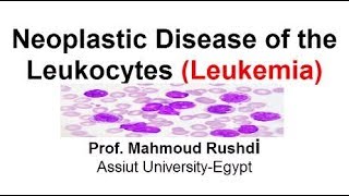 Neoplastic Disease of the Leukocytes  Leukemia Arabic Lecture [upl. by Yager]