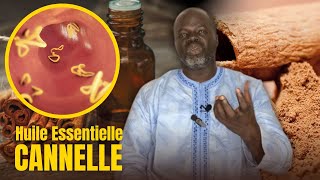 Bienfaits Huile Essentielle de Cannelle  Pr Ousmane Ndiaye  LansarrTV [upl. by Jonny]