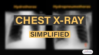 How to read a Chest XRay Radiological Anatomy Exam oriented [upl. by Charbonnier717]