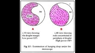 Hanging Drop Preparation [upl. by Philina]