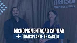 Micropigmentação capilar  Transplante Capilar transplantecapilarfue micropigmentaçãocapilar [upl. by Ecnarretal818]