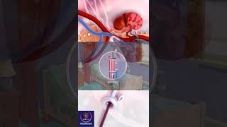 Artificial kidney or Dialysis education shorts [upl. by Htebesile903]