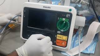 Philips Difibrilator DFM 100 Testing amp Analyser Procedure [upl. by Tyika]