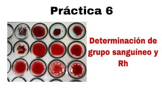 Práctica 6 Determinación de grupo sanguíneo y Rh [upl. by Eardnoed]