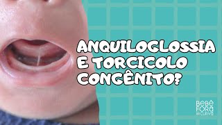 Existe relação entre anquiloglossia e torcicolo congênito RESPONDENDO PERGUNTAS [upl. by Adlen365]