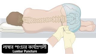 How to Perform a Lumbar Puncture [upl. by Kcirdet]