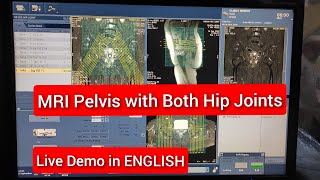 Pelvis with Both Hip Joint MRI scan Protocol Positioning amp Planning  Live Demo in English [upl. by Hubey568]