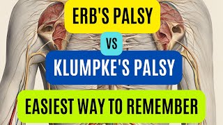 Erbs Palsy Vs Klumpkes Palsy  Brachial Plexus Injury  Easy Way To Remember [upl. by Ornie]