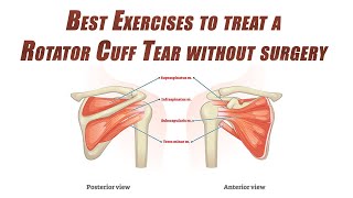 Best SelfTreatment of a Rotator Cuff Tear  Shoulder Rehab without Surgery [upl. by Markus]