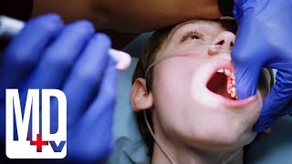 Poor Oral Hygiene Ends in Brain Infection  Chicago Med  MD TV [upl. by Felecia]