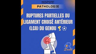 Rupture Partielle du LCA  Comprendre Diagnostiquer et Traiter LCA Kinésithérapie [upl. by Jurkoic]