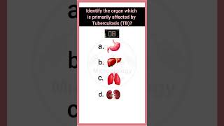 Quiz14 Bacterial disease  disease microbiology microbiologymcq bacterialdiseases pathology [upl. by Lladnor175]