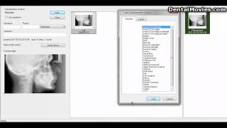 The software FACAD  Import a DICOM image file 19 [upl. by Bernj]