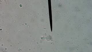 Giardia in a Dog Stool Sample Found by Direct Fecal Smear 40X [upl. by Ahseihs]