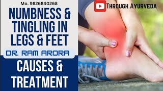 Leg Numbness Paresthesia Treatment  पैर सुन्न होना पेरेस्थेसिया  पैर सुन्न होने पर क्या करें [upl. by Gabbie]