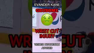 EVANDER KANE GRUSOME WRIST INJURY [upl. by Koh13]