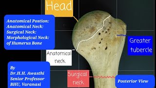 Anatomy of Humerus Anatomical Position Side Determination Neck Anatomical Surgical Morphological [upl. by Massie]