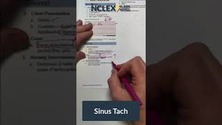 Sinus Tachycardia assessment and treatment [upl. by Atihcnoc485]