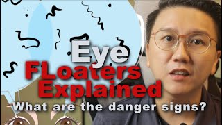 Eye Floaters Explained  Risks Causes and Symptoms [upl. by Ambrogio]