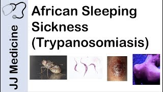 African Sleeping Sickness Trypanosomiasis  Causes Symptoms and Treatment [upl. by Profant]