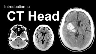 Introduction to CT Head Approach and Principles [upl. by Laertnom]