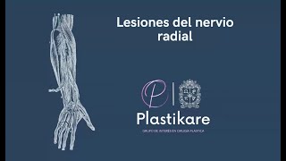 Lesiones del nervio radial Grupo de interés en Cirugía Plástica UN [upl. by Nonaihr]