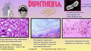 Corynebacterium diphtheriae Morphology and pathogenesis [upl. by Eillit]