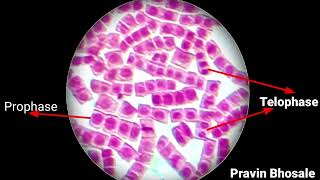 How to identify mitosis stages under microscope  Mitosis Slide  Prophase  Metaphase  Anaphase [upl. by Rillings]