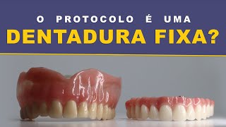 DENTADURA FIXA É PROTOCOLO [upl. by Tichon753]