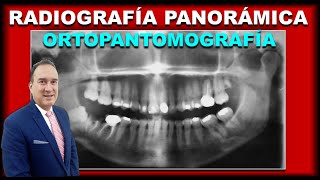 RADIOGRAFIAS PANORAMICAS DENTALES INTERPRETACION EN ORTODONCIA [upl. by Natye]