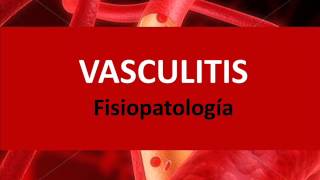 Vasculitis  Fisiopatología [upl. by Gelya]