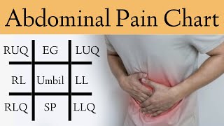 Abdominal Pain Causes by Location and Quadrant Differential Diagnosis Chart [upl. by Kris758]