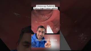 What A Colonoscopy is Really Like [upl. by Barimah496]