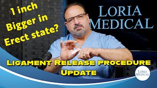 Ligament Release procedure Update 2024 [upl. by Rosario]